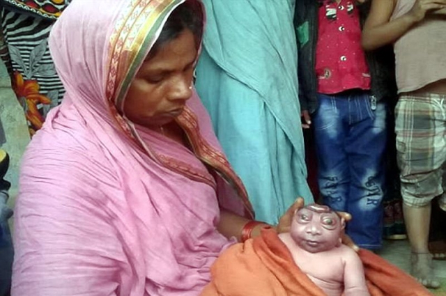 Photo of بھارت میں تاریخ کا خوفناک ترین بچہ پیدا ہوگیا، مگر بھارتیوں نے اس کی بھی پوجا شروع کردی