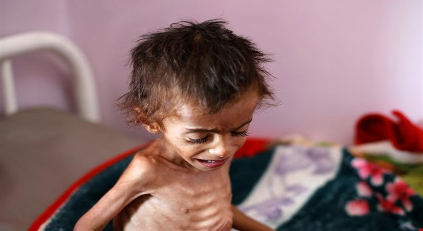 Photo of سعودی جارحیت: یمن میں 18 لاکھ بچوں کو خوراک میسر نہیں، اقوام متحدہ