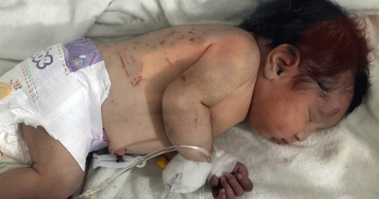 شام میں زلزلے کے ملبے میں دبے ہوئے نومولود بچے کو پیدائش کے بعد بچا لیا گیا